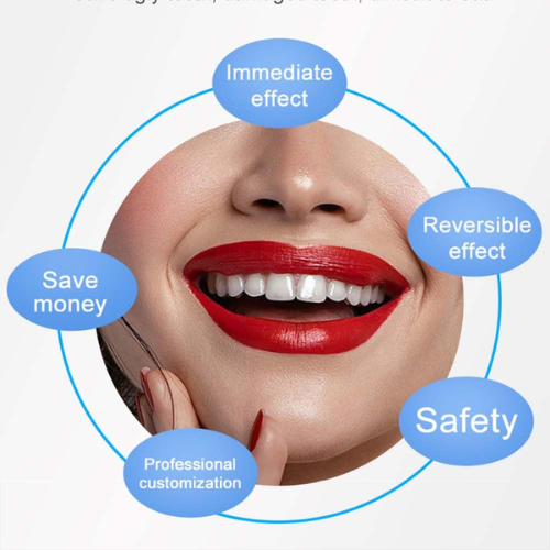 Snap On Smile – Instant Perfect Teeth Veneers (No Dentist Required)