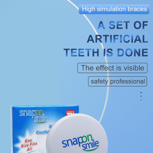 Snap On Smile – Instant Perfect Teeth Veneers (No Dentist Required)