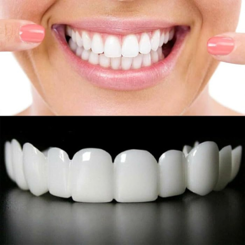 Snap On Smile – Instant Perfect Teeth Veneers (No Dentist Required)
